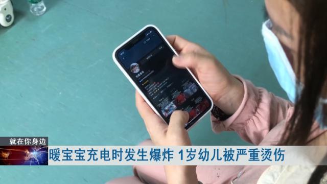 充电时爆炸，致一岁幼儿严重烫伤，这种产品很多人都用过