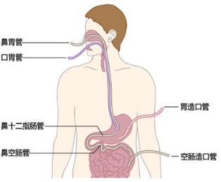 肿瘤患者要想活得好，这8个饮食误区要避免。