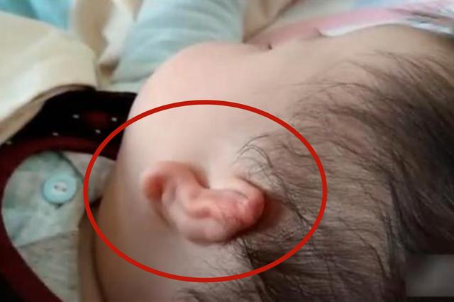 「天使宝贝」见过这样的智能耳朵吗？听见爸爸打呼噜自动关闭，宝妈发圈叹神奇