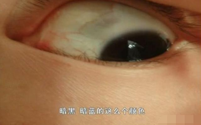 超级宝妈|女娃眼里出现多个黑点，奶奶自以为的“哄娃神器”，正是罪魁祸首