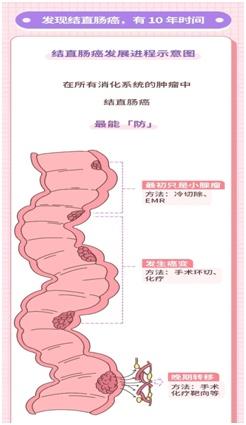 检查|一定要知道！发现消化道肿瘤的“武器”就是这项检查