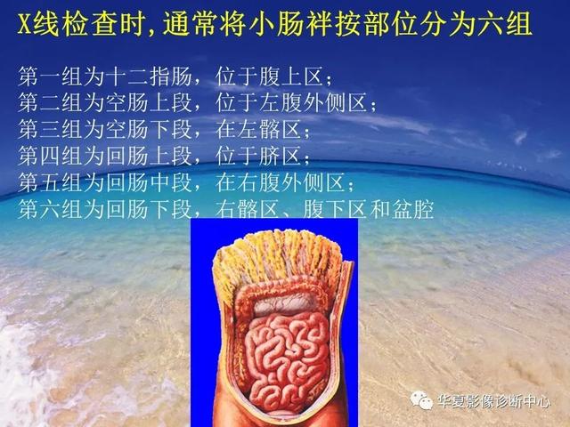 消化道穿孔的CT诊断