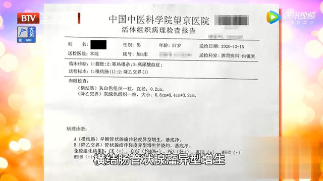 脸上三角区有色素沉着，易患肠息肉！一杯代茶饮，预防息肉少复发