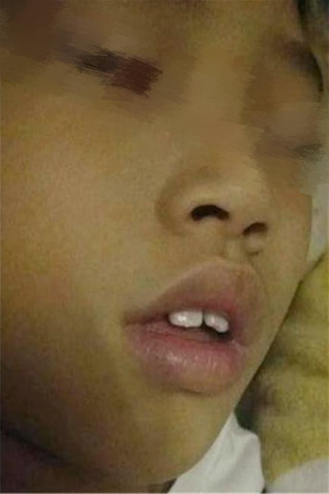超级宝妈■挺可爱的孩子结果越长越丑，甚至像“猩猩”？检查之后宝妈后悔了