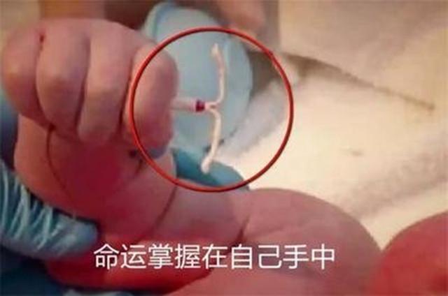 你的育儿经|第一批“上环”的人现在怎样了?4种不同经历,看着令人心疼