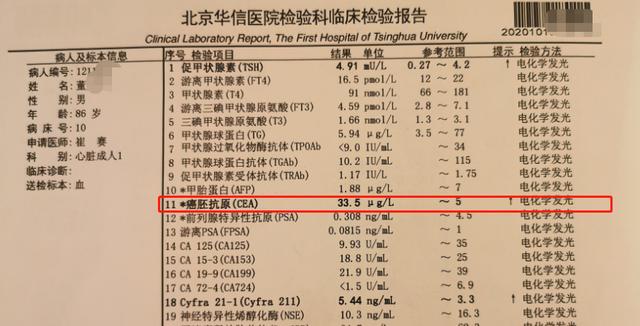 5年肺结节不管不顾，大爷终查出肺癌！什么样的肺结节容易癌变？