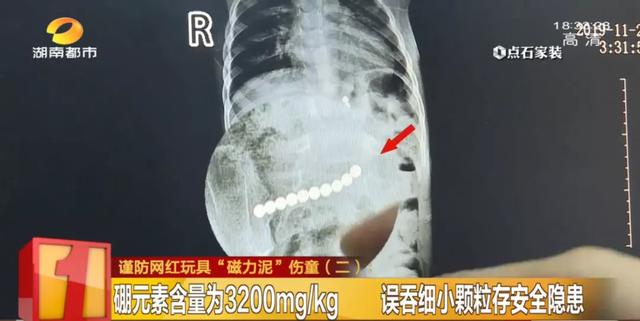【芒果都市】长沙很多学校门口都在卖！这款网红玩具已导致多名儿童误吞中毒！粘手上很难洗、易从口鼻进入体内…