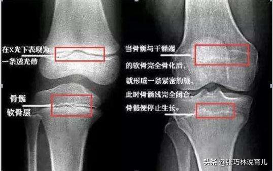 「你的育儿经」身高是条单行线，“晚长”不能凭经验盲目等待，3招辨清