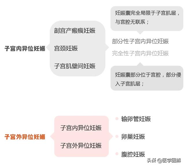 你的育儿经■ESHRE关于正常位置妊娠和异位妊娠术语的专家共识