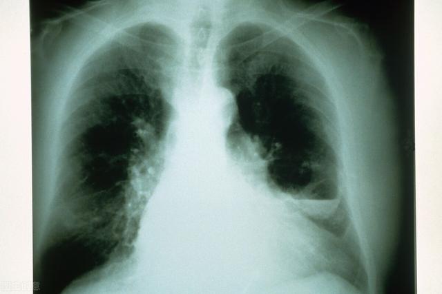 经常咽喉部疼痛？快来了解一下是不是患了这两种疾病