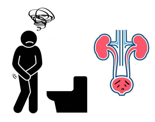 小便时若出现4种表现，要当心，这或是膀胱癌已靠近的信号