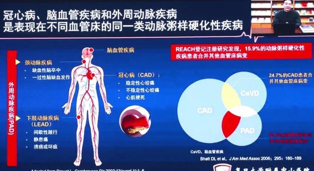 中华医学杂志创刊105周年纪念会心血管代谢与精准医学论坛召开