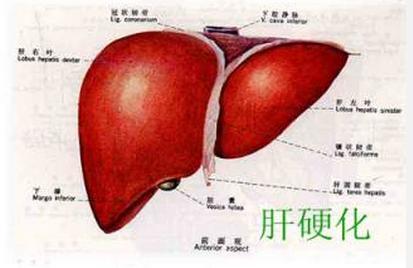 肝硬化的病因有哪些？肝硬化病人手术麻醉有什么特点？