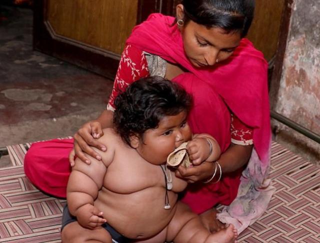 [超级宝妈]1岁体重就高达45斤的“米其林宝宝”，如今啥样了？不出人们所料