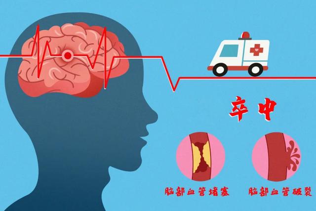 血管|身体3个地方疼，可能是血管堵了！老中医调养食疗方，你家也有