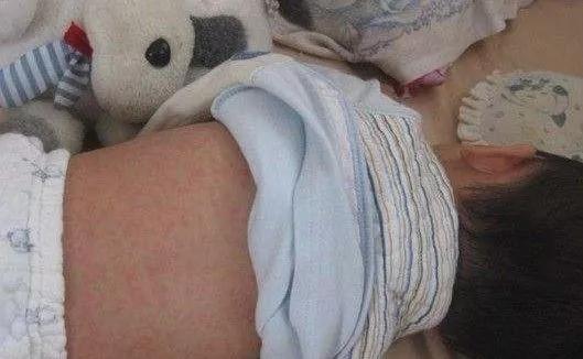 安全港|阜新阳光大姐｜|最容易误判的新生儿常见病详解