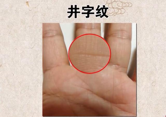 血脂异常的蛛丝马迹，在身上的这些地方就可以找到
