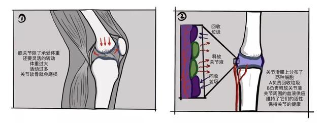 膝关节一活动，时不时传来“咔咔咔”的响声，需要治疗吗？