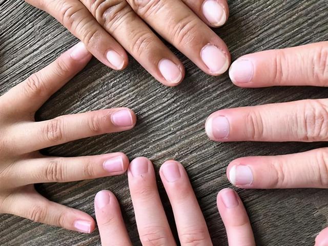 为什么很多人指甲上有月牙，有的人却一个都没有？科学解释来了