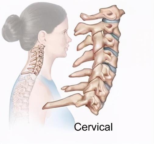 颈椎病患者的自我救赎