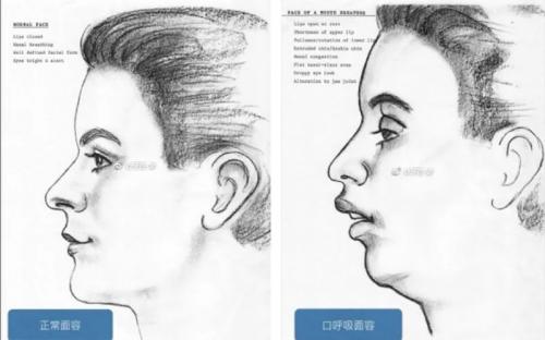 超级宝妈：三岁看大~七岁看老：换牙期重点问题