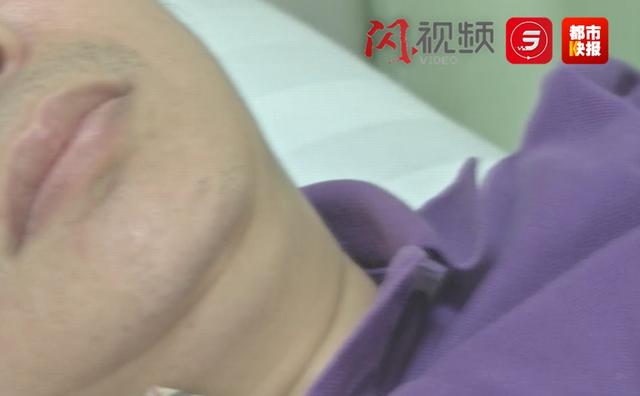 鱼刺|山西男子吃了顿饭差点要了命，紧急奔赴陕西求医，只因一根小小的……