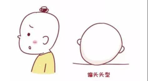 【你的育儿经】头圆就是高智商的象征？我们扁头宝宝表示特别不服