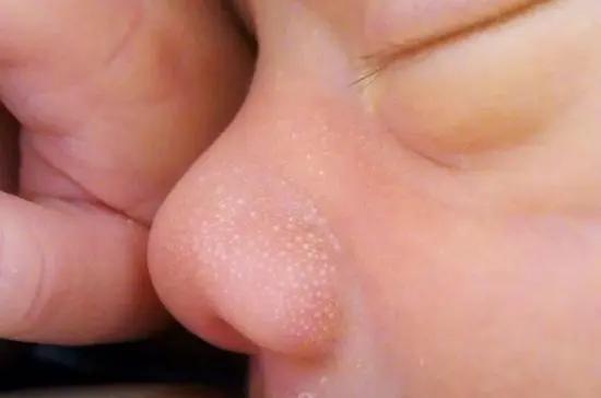 「超级宝妈」新生宝宝的这些现象令人担忧？有些不必担心，但有些一定要注意