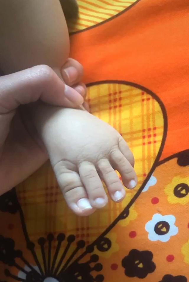 #你的育儿经#宝宝脚趾比手指还要长，妈妈看了就头疼，网友：夏天不敢穿凉鞋了
