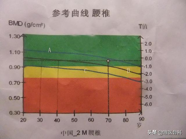 骨折拍了X线，为什么还要做CT和磁共振？