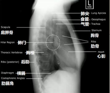 读完此文，终于会看儿童胸片了