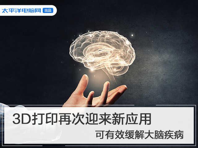 #勇哥科技#3D打印再次迎来新应用 可有效缓解大脑疾病