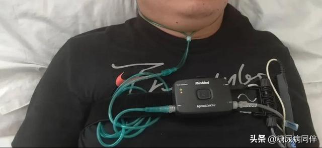 糖尿病控制不好，会合并9类并发症