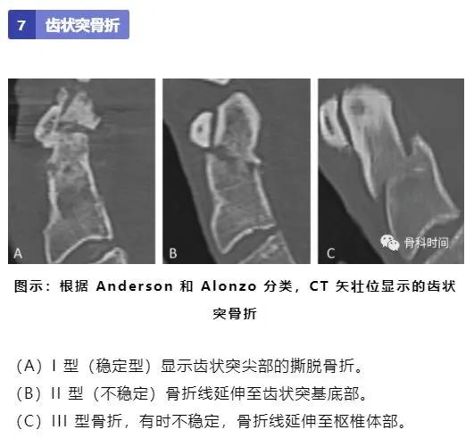 影像经验！脊柱的 13 个影像学特征