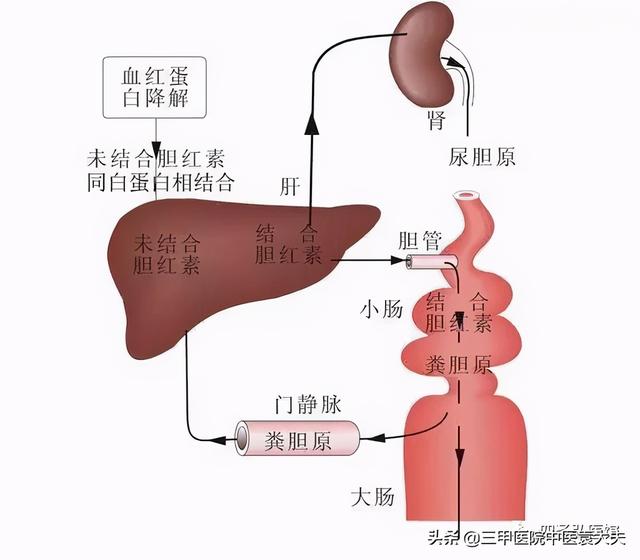 迈入中医之门第85篇：黄疸病论治