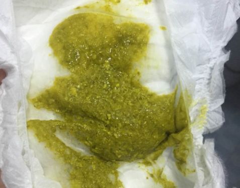 「暖先生格调」宝宝拉绿便就是奶粉的“锅”？饥饿、辅食......这些都可能，附图干货拿去！
