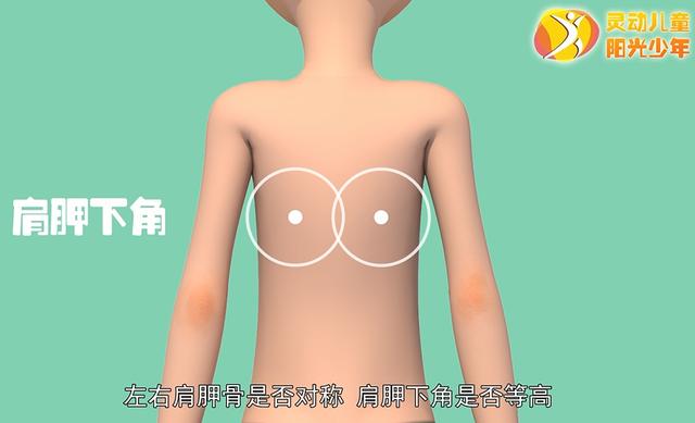 健康学堂|孩子高低肩，可能是病，这些脊柱侧凸自查方法，家长们一定要收藏