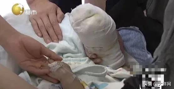 大洋网|17个月大宝宝被严重烫伤！奶奶第一时间一个举动，雪上加霜