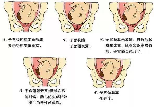 专题科普：要生了要生了，怎么办（二）？