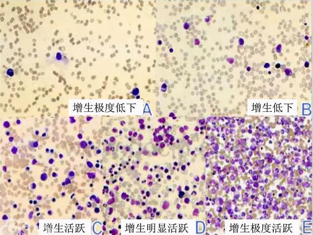 查出来胃黏膜“肠化、不典型增生”，就只能“等它癌变”吗？