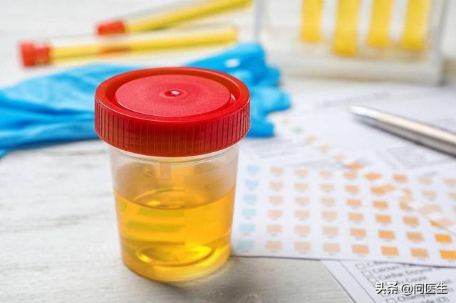 男性出现泡沫尿怎么回事？医生告诉你，这些疾病会导致尿中有泡沫