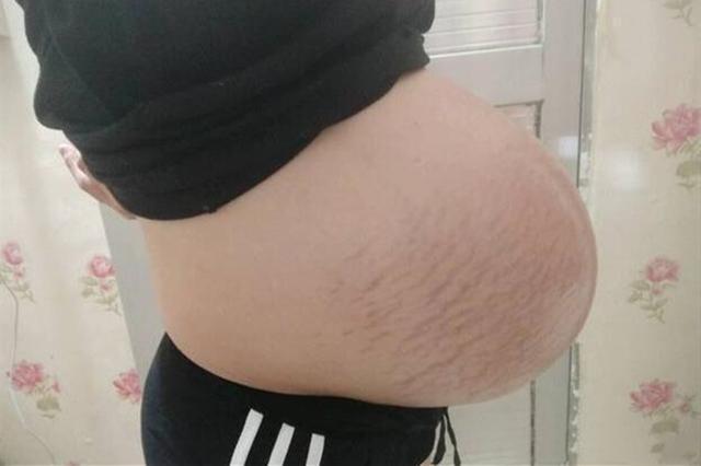 超级宝妈|孕妇“悬浮肚”是咋回事？跟多胞胎关系不大，可能是“头盆不称”