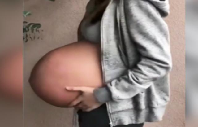 婉转应和|孕妈“子弹肚”走红,网友猜测多胞胎,医生:不要太乐观