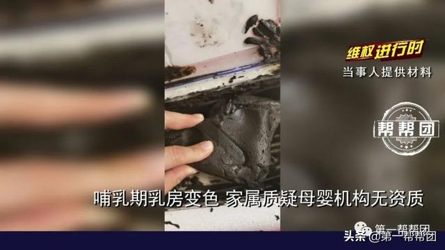 [你的育儿经]新手妈妈乳房胀痛，热敷多次乳房变成焦糖色，母婴机构回应