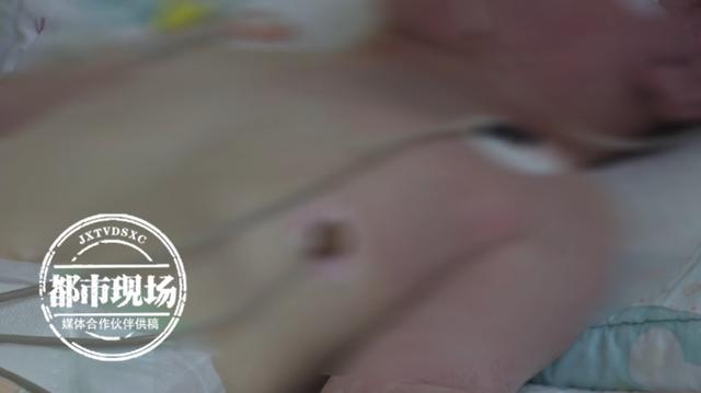 你的育儿经|5岁女儿大片“胎记”，抽搐休克都因为它