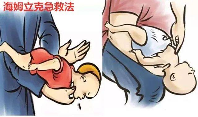 你的育儿经■男童误抠气枪扳机，竟致铁钉穿耳！家有“神兽”您需Get这些知识