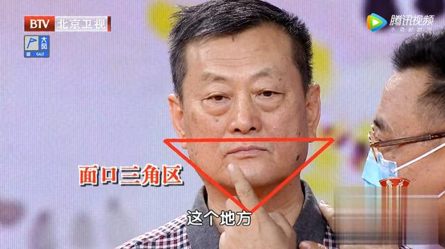 脸上三角区有色素沉着，易患肠息肉！一杯代茶饮，预防息肉少复发