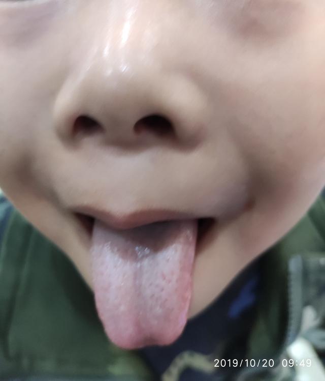 [你的育儿经]你的脾胃健康吗？