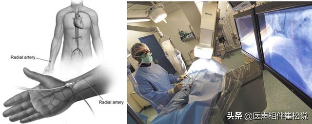 心电图|得了心脏病哪些检查最准确？这份“心脏检查指南”请收好！