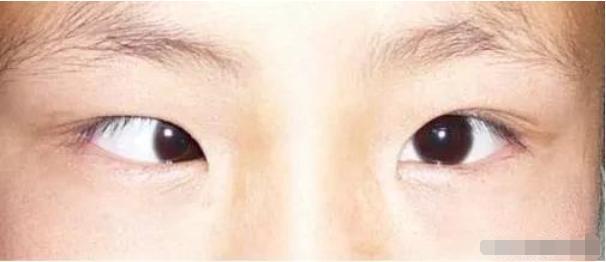『超级宝妈』儿童使用手机不当，危害有多大？5岁男童一觉醒来桌椅板凳变双份